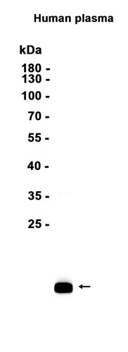AYD11079