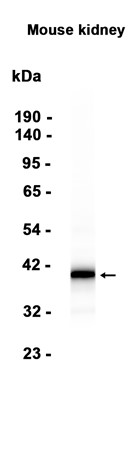 AYD13725