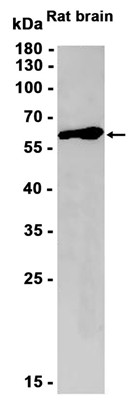 Fyn (YD14410) Rabbit mAb