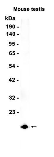AYD14640
