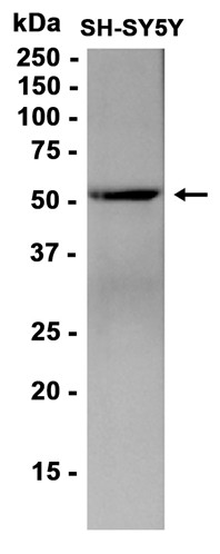 C9orf72 (YD16164) Rabbit mAb