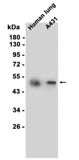 Cytokeratin 14 (YD18501) Rabbit mAb