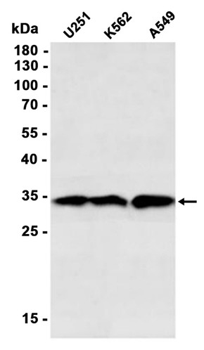 AYD14175