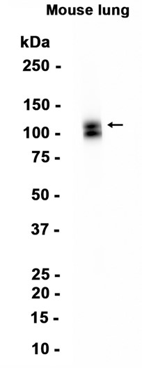 CD31 (YD14420) Rabbit mAb