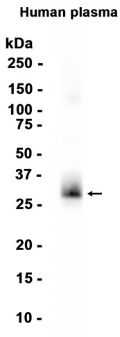 AYD14587