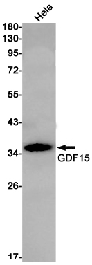 AYD11261