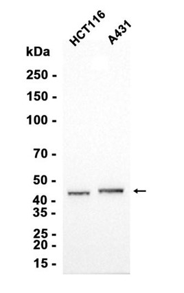 Cyclin B2 (YD31446) Rabbit mAb