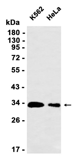 AYD12058