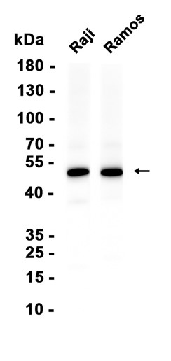 NCF1 (YD36176) Rabbit mAb
