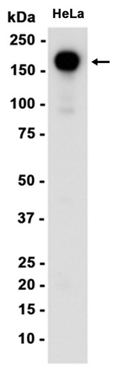 EGFR (YD13669) Rabbit mAb