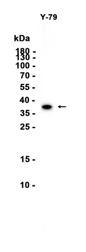 AYD16010