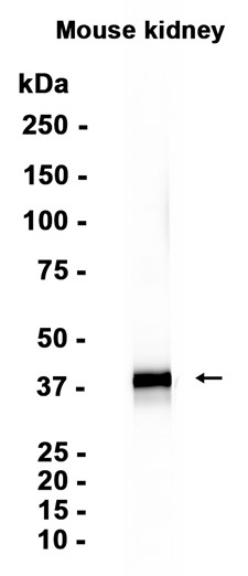 EpCAM (YD20941) Rabbit mAb
