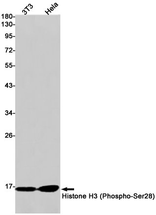 Phospho-Histone H3 (Ser28) (YD16826) Rabbit mAb