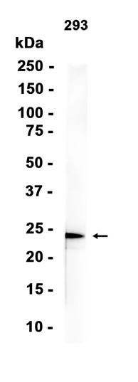 AYD12179