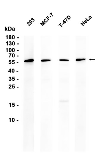 Estrogen Receptor beta (YD36295) Rabbit mAb