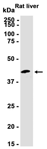 AYD14956