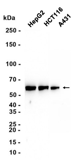 AYD11434