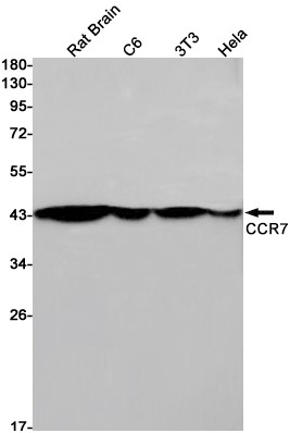 AYD11393