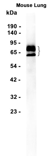 TGF beta Receptor II (YD33725) Rabbit mAb