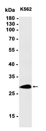 AYD14422