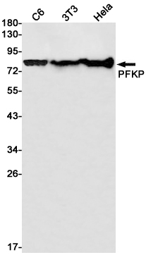 AYD11238