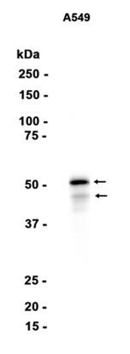 GSK3 alpha/beta (YD14262) Rabbit mAb