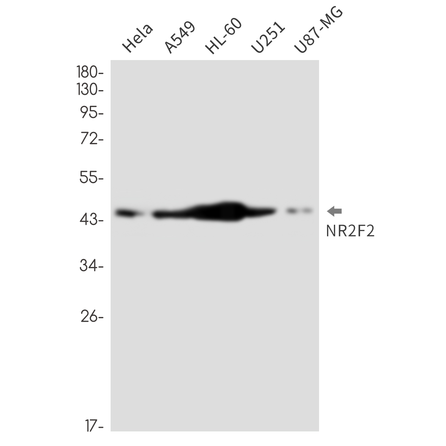 AYD12635