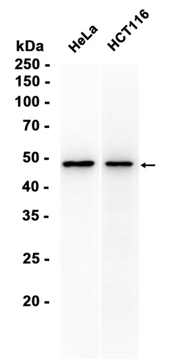 AYD11056