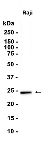 MAD2L1 (YD36159) Rabbit mAb