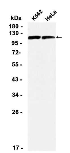 AYD11636
