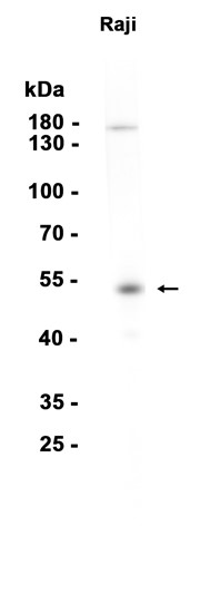 ETS1 (YD16142) Rabbit mAb