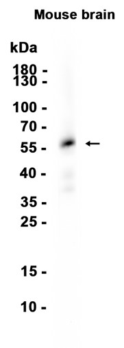 TPH2 (YD31156) Rabbit mAb
