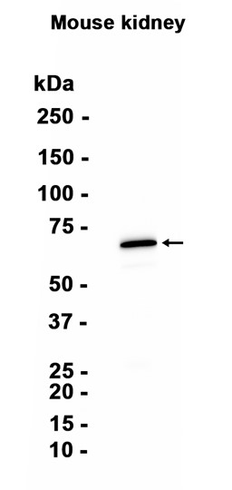 AYD15171