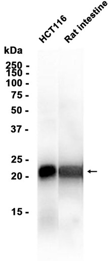 Ferritin Heavy Chain?(YD13104) Rabbit mAb
