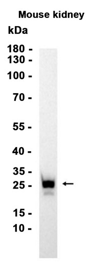 AYD15852