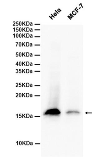 CDKN2A/p14ARF (YD14390) Rabbit mAb