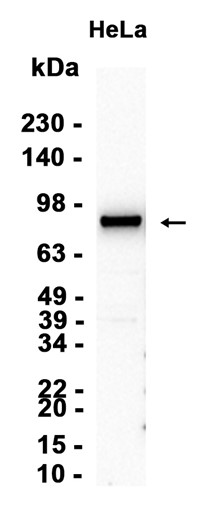 AYD11256