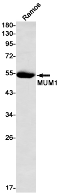 AYD12395