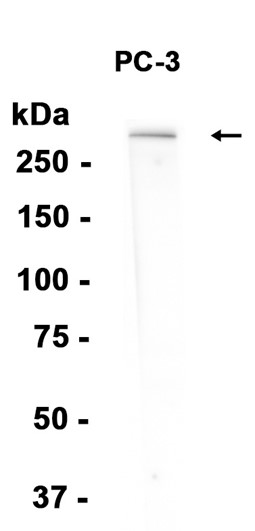 AYD14690