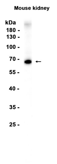AYD15418