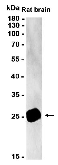 AYD11099