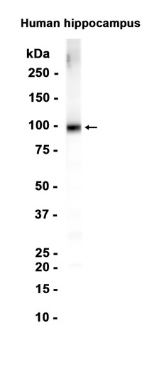 AYD15542