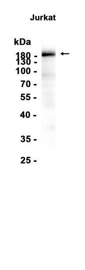 CD45 (YD14623) Rabbit mAb