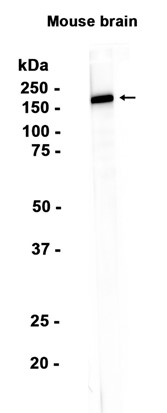 AYD14580