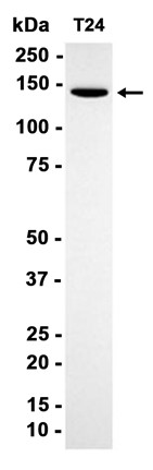 AYD11098