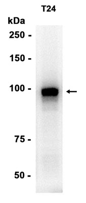 AYD14875