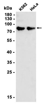 AYD11991