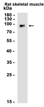 Glucocorticoid Receptor (YD12433) Rabbit mAb