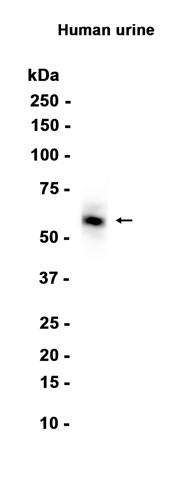 AYD14968
