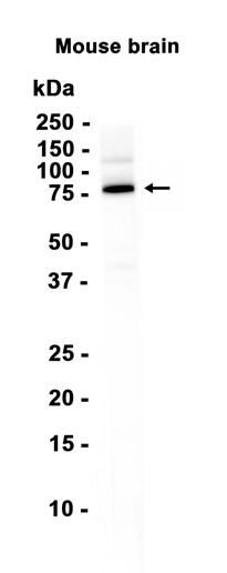 AYD16385
